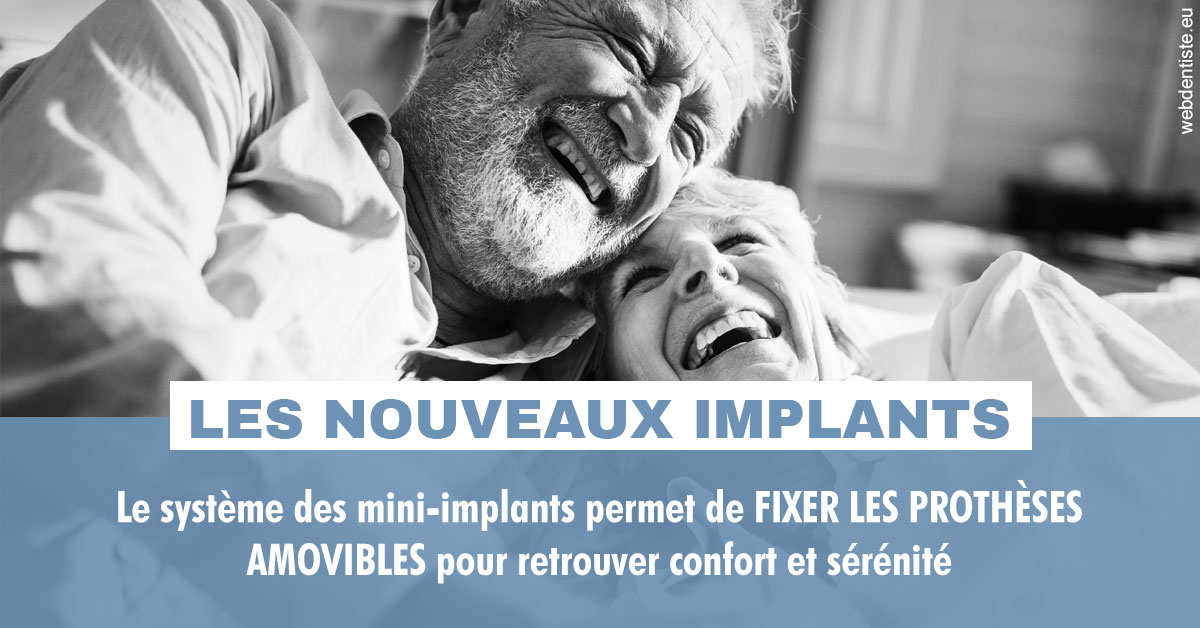 https://selarl-dr-leboeuf.chirurgiens-dentistes.fr/Les nouveaux implants 2
