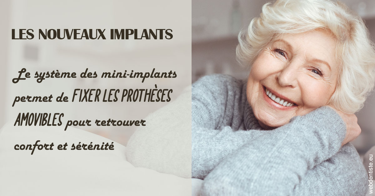 https://selarl-dr-leboeuf.chirurgiens-dentistes.fr/Les nouveaux implants 1