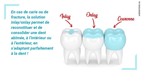 https://selarl-dr-leboeuf.chirurgiens-dentistes.fr/L'INLAY ou l'ONLAY