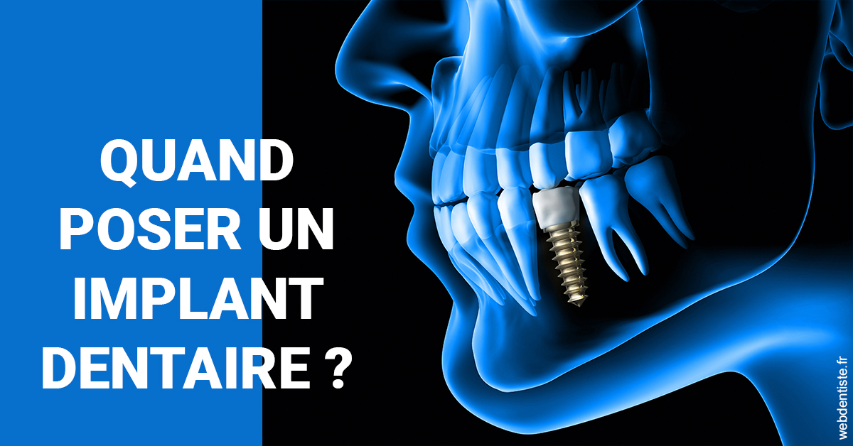 https://selarl-dr-leboeuf.chirurgiens-dentistes.fr/Les implants 1