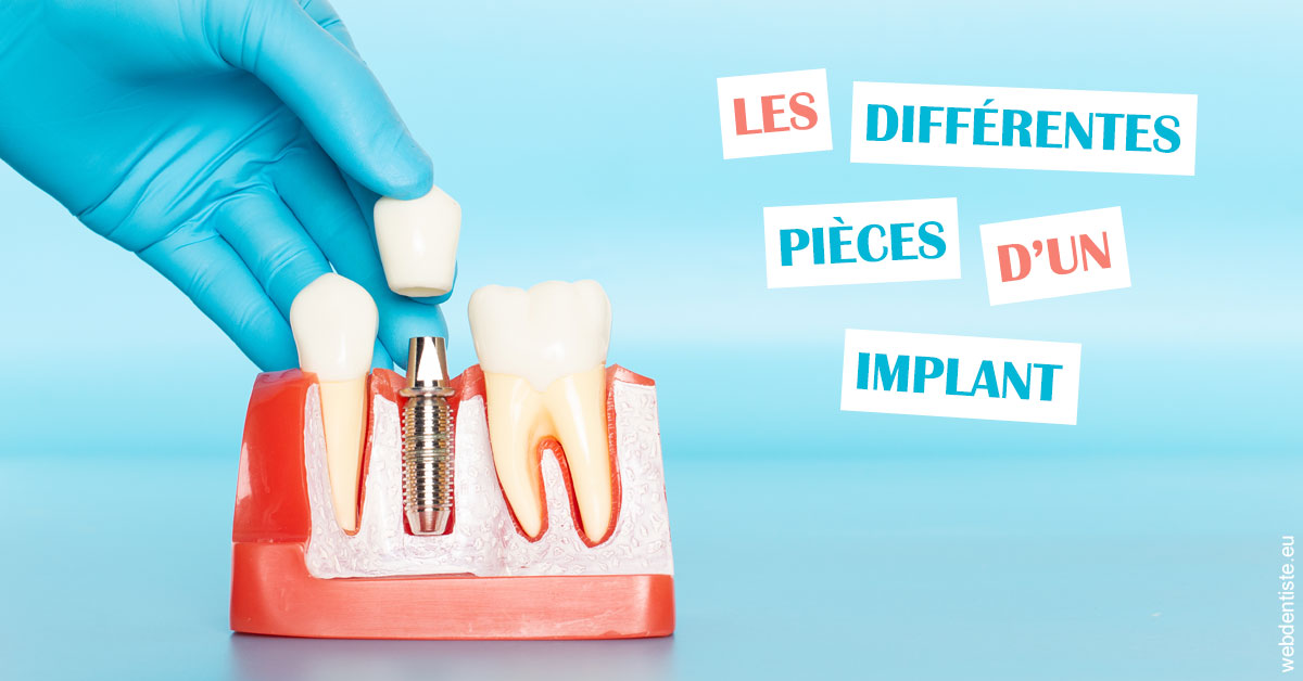 https://selarl-dr-leboeuf.chirurgiens-dentistes.fr/Les différentes pièces d’un implant 2