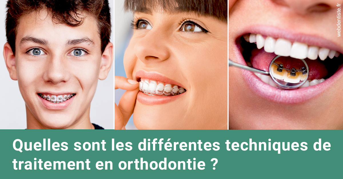https://selarl-dr-leboeuf.chirurgiens-dentistes.fr/Les différentes techniques de traitement 2
