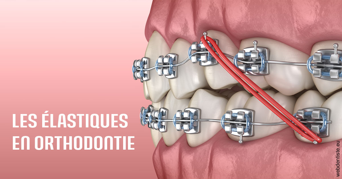 https://selarl-dr-leboeuf.chirurgiens-dentistes.fr/Elastiques orthodontie 2