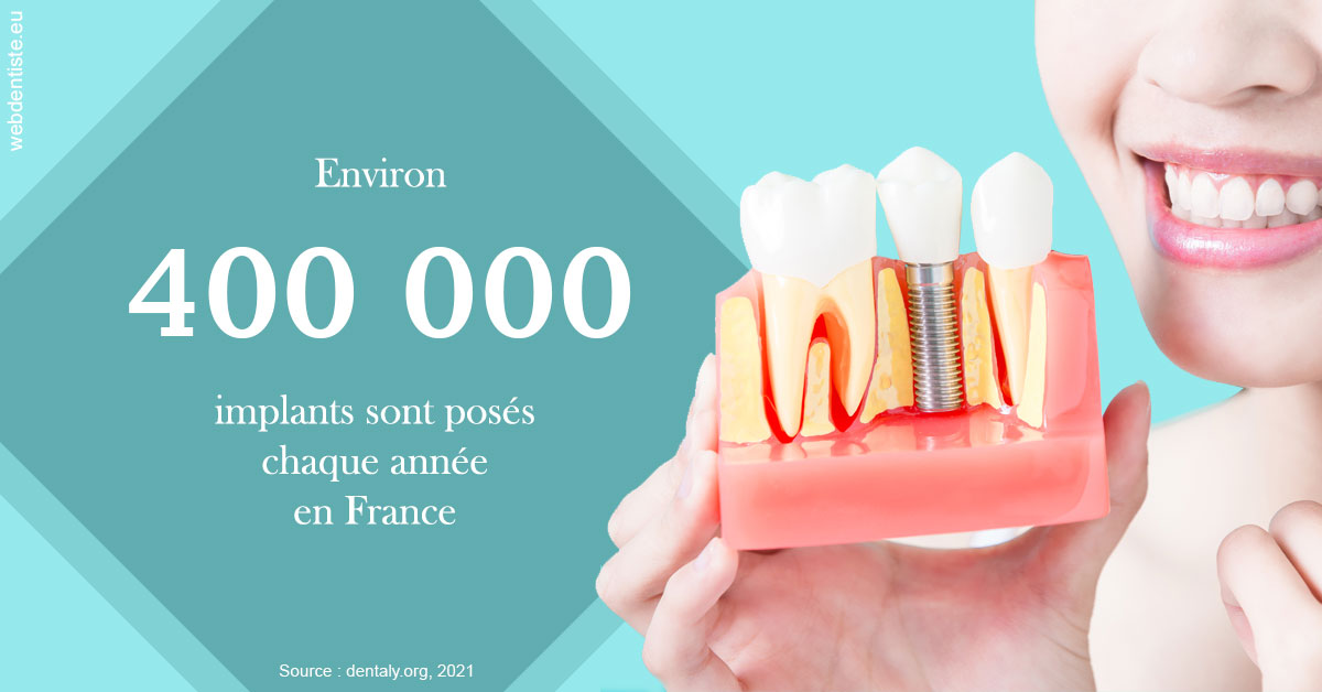 https://selarl-dr-leboeuf.chirurgiens-dentistes.fr/Pose d'implants en France 2